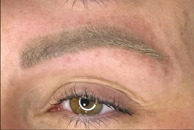 Camouflage & Tattoo Removal MasterClass
