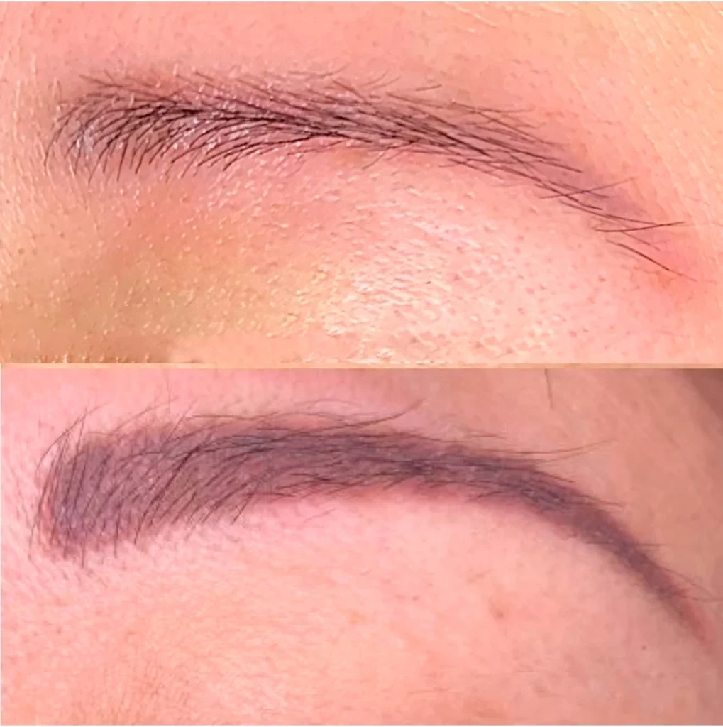 Camouflage & Tattoo Removal MasterClass – Ergebnis 5